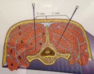 Kuru İğne, İntramusküler stimülasyon (IMS)